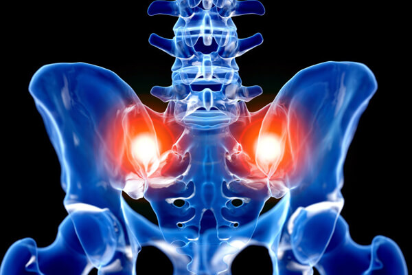 xray of si joints showing dysfunction