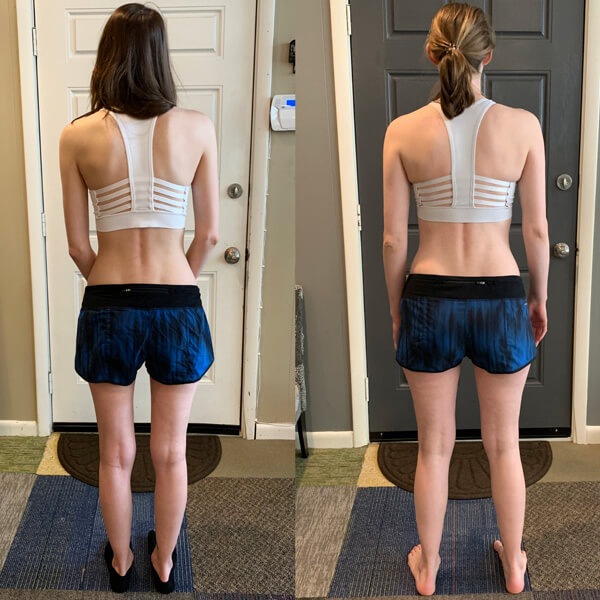 Functional Patterns Chattanooga results pain & structure - rear view