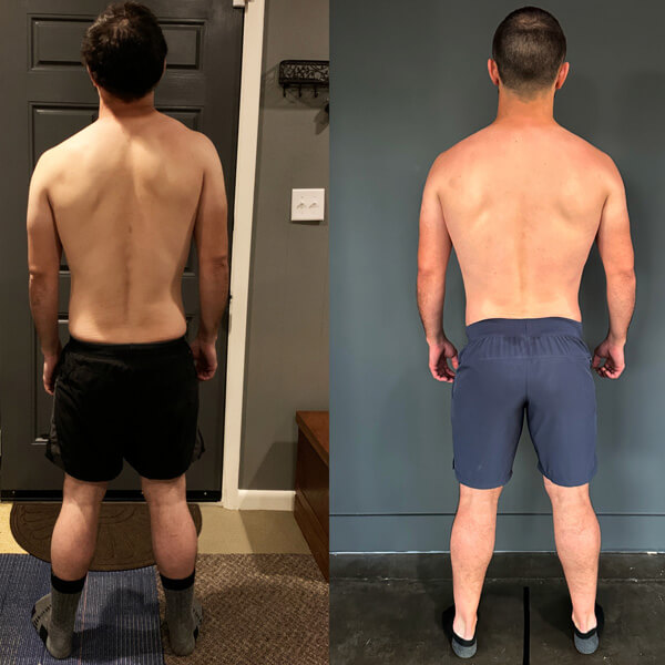 Functional Patterns Chattanooga results shoulder & neck pain - rear view