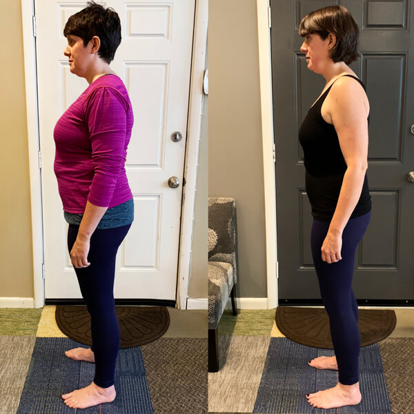 Functional Patterns Chattanooga results weight loss & back pain - side view