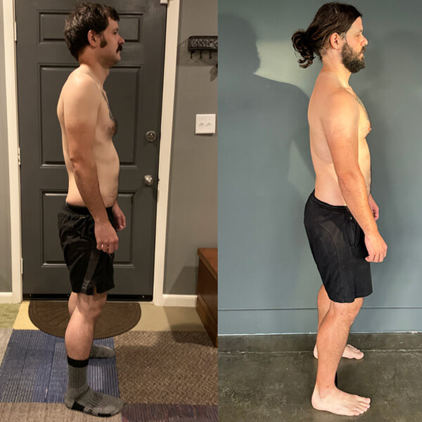 Functional Patterns Chattanooga results shoulder & neck pain - side view